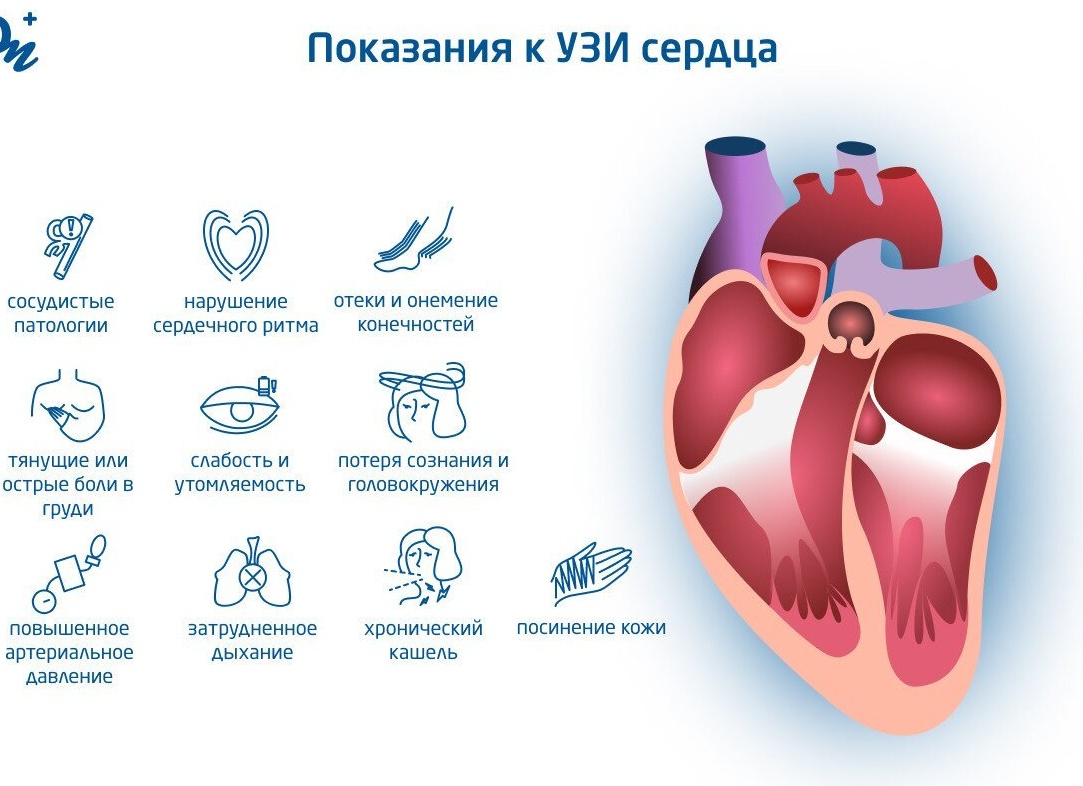 УЗИ сердца и сосудов: что проверяет и как подготовиться?
