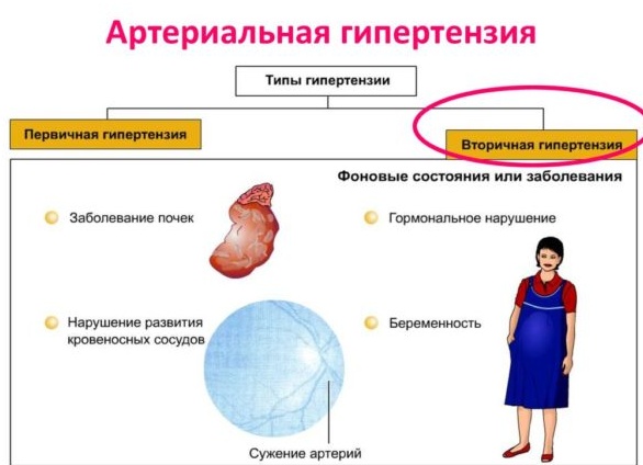 Симптоматические артериальные гипертензии. Классификация. Факторы развития.</p>
<p>Схема обследования при артериальной гипертензии. Дифференциал