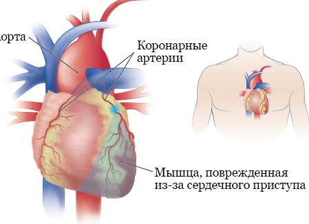 Всё об артериальном давлении: норма, причины отклонений, профилактика и лечение