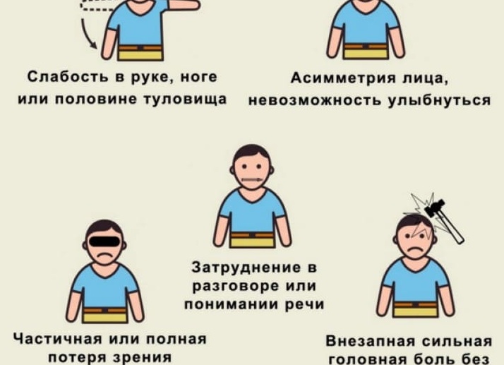 Причины и симптомы инсульта