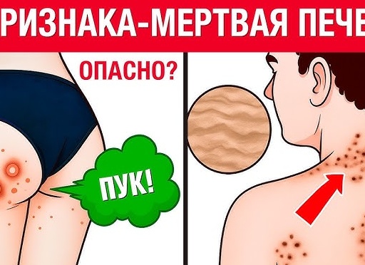 👀 Неочевидные сигналы: 11 признаков проблем с сердцем