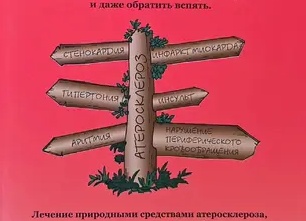 «Атлас Атеросклероза» расскажет как предотвратить инфаркт или инсульт