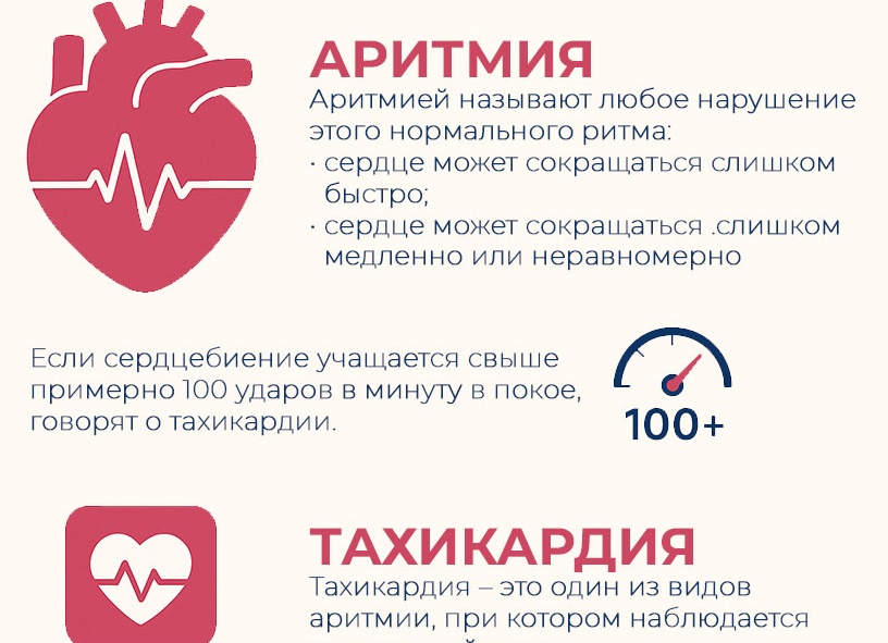 Тахикардия: что вызывает учащенное сердцебиение и пульс