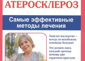 Атеросклероз: что вы знаете о сосудах, холестерине и бляшках?
