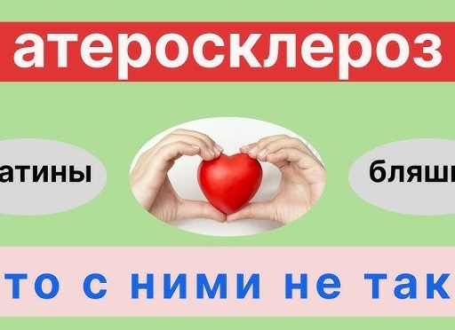 Атеросклероз - причина ифарктов, инсультов и ишемической болезни