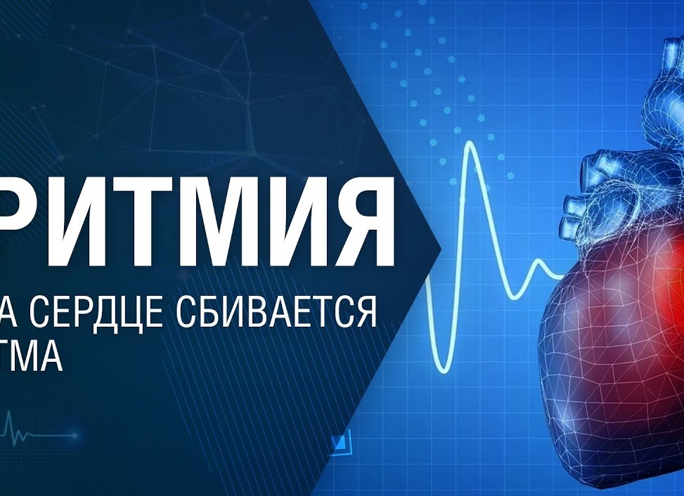 «Сердце сбивается с ритма»: что такое мерцательная аритмия — просто, честно и без паники