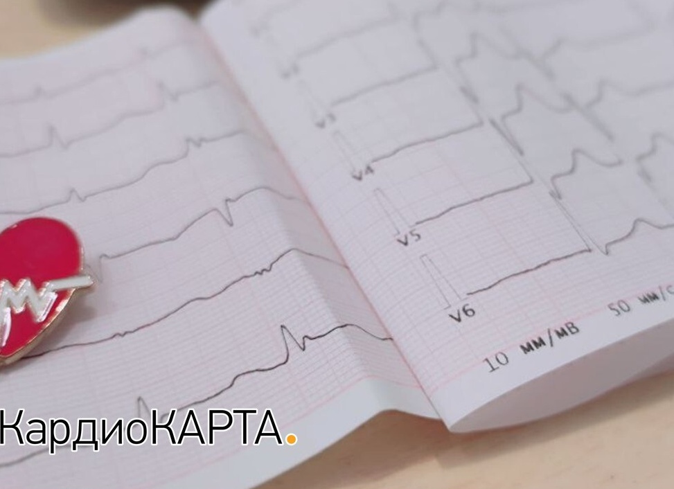 Пульс и давление: как они взаимосвязаны?