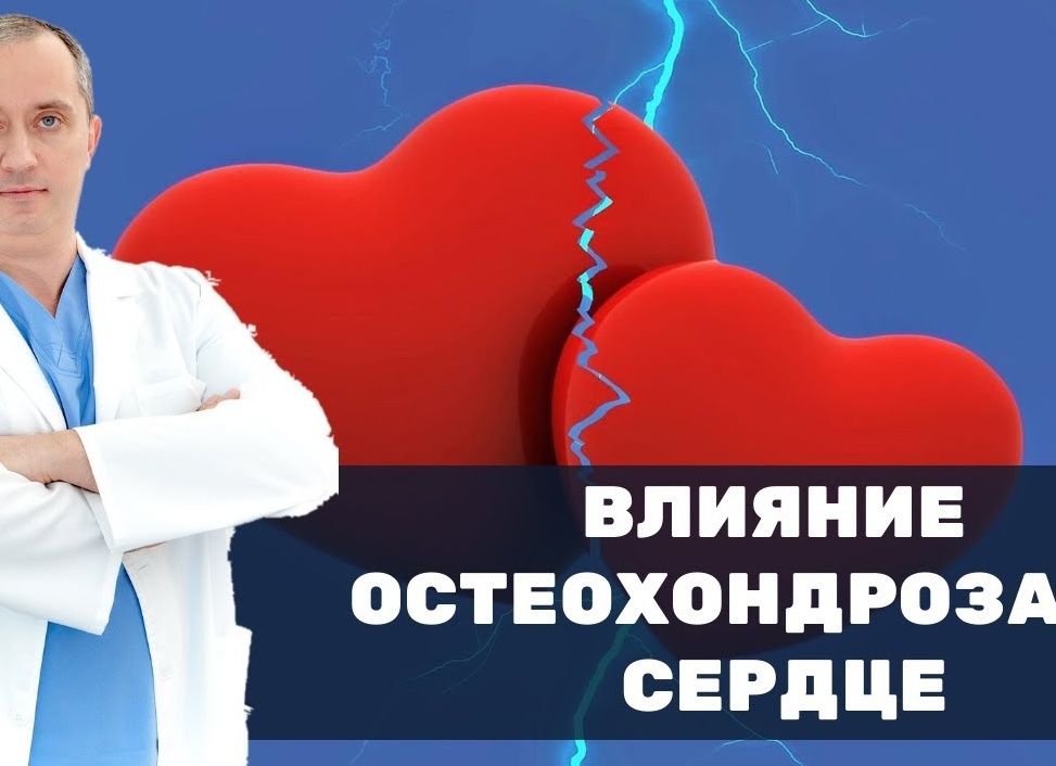 Влияние шейного остеохондроза на сердце